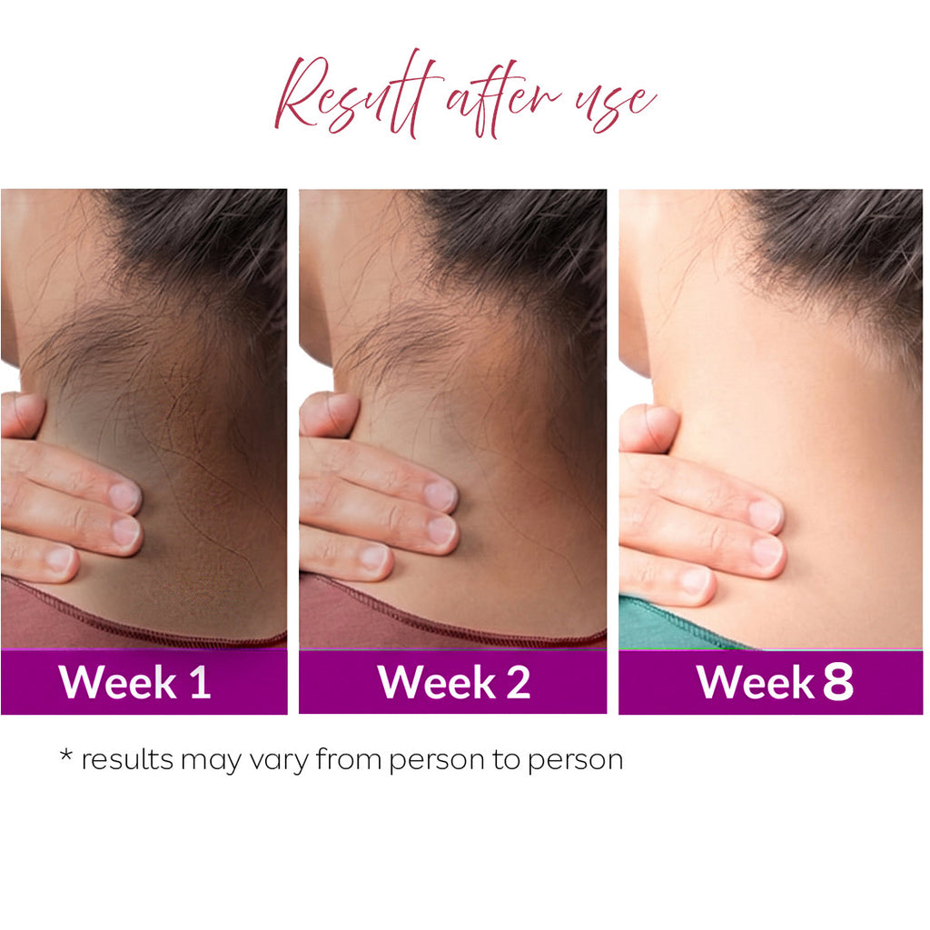 Neckline Dark Neck Corrector Roll On
