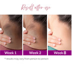 Neckline Dark Neck Corrector Roll On