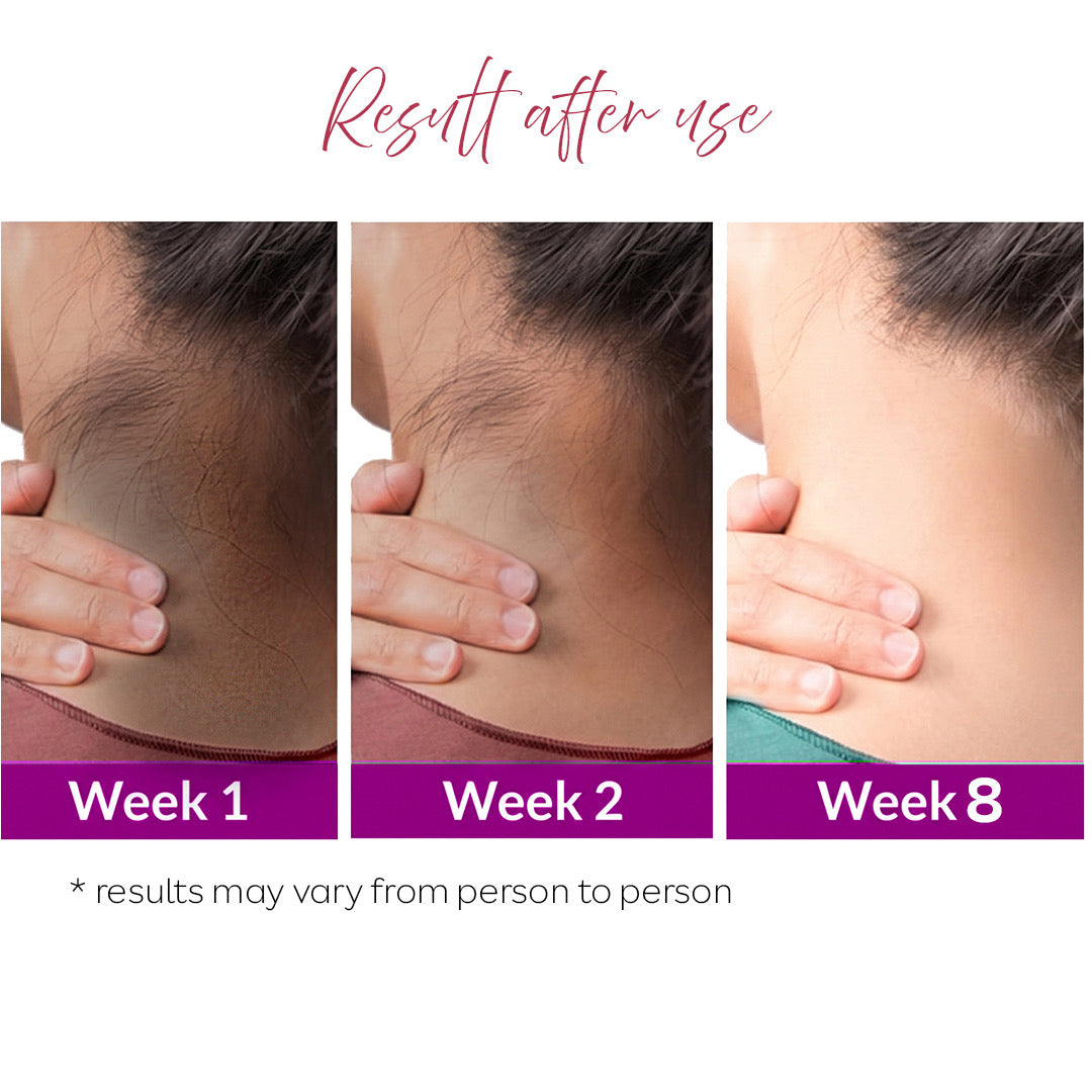 Neckline Dark Neck Corrector Roll On